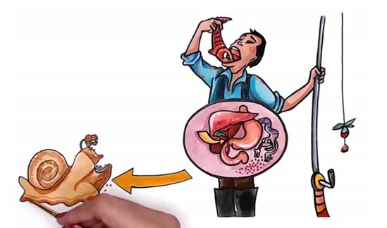 Opisthorchiasis-or-Liver-Fluke